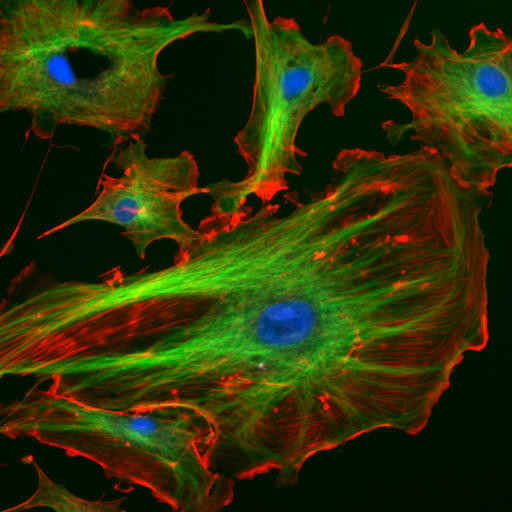 Immagine al microscopio con strutture citoscheletriche colorate all'interno delle cellule